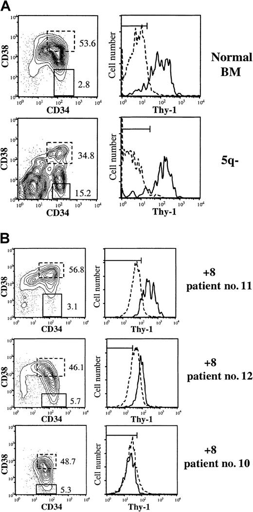 Fig. 1. Thy-1 (CD90) expression within CD34+CD38− HSC compartment in MDS patients. / BM CD34-enriched cells (not MNC) were stained with MoAbs against CD34, CD38, and Thy-1 or irrelevant isotype control Abs. (A) Expression profiles of CD34+ cells from healthy subject and MDS case with del(5q). (B) Expression profiles of 3 MDS cases with trisomy 8. Left panels show coexpression of CD34 and CD38, with numbers indicating percentages of CD34+CD38+ and CD34+CD38− cells (of total CD34+cells) further investigated for Thy-1 expression in right panels. Dotted and solid lines represent Thy-1 expression on CD34+CD38+ and CD34+CD38− cells, respectively. Horizontal bars in the Thy-1 diagrams indicate gates for negative isotype control Ab, including at least 99% of CD34+CD38−cells.