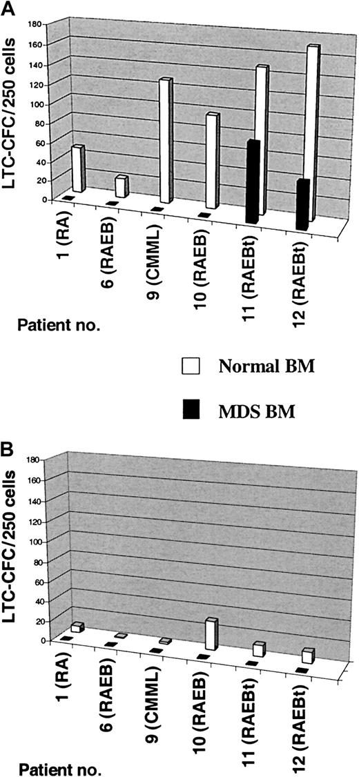Fig. 3. LTC-IC activity of CD34+CD38−and CD34+CD38+ cells in MDS cases with +8. / Six-week LTC-CFC activity of MDS BM CD34+CD38−(A) and CD34+CD38+ (B) cells was evaluated as described in “Patients, materials, and methods.” CD34+CD38− and CD34+CD38+ cells from healthy subjects were included as controls in all experiments. After 6 weeks of culture, the number of CFCs produced was evaluated in methylcellulose. Results are the mean of 3-6 replicate wells from each cell population and patient. For patients #1 and #6 human allogeneic stroma was used while murine stromal feeders was used for patients #9, #10, #11, and #12. Note that the number of colonies found for the normal controls evaluated on human allogeneic stromas (patients #1 and #6) are significantly lower than those evaluated on murine stromal feeders (patients #9, #10, #11, and #12), reflecting the higher efficiency of the murine stromal feeders. Note also that no LTC-CFC activity was observed in the CD34+CD38+ populations of any MDS patient or in the CD34+CD38− population from patients #1, #6, #9, and #10 and that the only 2 MDS patients with LTC-CFC activity derived from CD34+CD38− population were those with most advanced MDS (RAEBt with 20% and 25% BM blasts, respectively).