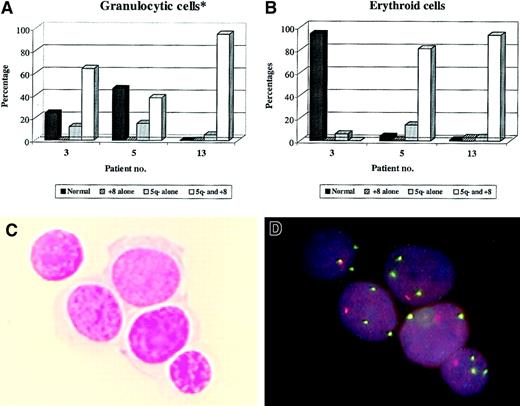 Fig. 5. Dual FISH analysis of BM smears from MDS cases with both del(5q) and trisomy 8. / MGG-stained BM smears from 3 MDS cases known to have both del(5q) and trisomy 8 were investigated by dual FISH analysis for presence of the 2 abberations in the granulocytic (A) and erythroid (B) lineages (as described in Table 5). Data are presented as percentage of total cells within each lineage that had a normal chromosome 5 and 8 status or different combinations of 5q deletion and/or trisomy 8 (cutoff value at 2%-3% marked with horizontal lines). *See Table 5. Also shown is an example of MGG-stained erythroid cells (C) from patient no. 5 and the subsequent dual FISH analysis of the same cells (D). Note that all cells have both del(5q) and trisomy 8. Original magnification approximately × 1000.