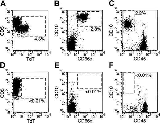 Fig. 1. Detection of residual disease by flow cytometry on day 19 of remission-induction therapy. / Bone marrow samples were obtained on day 19 from 6 patients with newly diagnosed ALL. All 6 samples lacked leukemic cells identifiable by morphologic analysis. Dot plots at left show flow cytometric results illustrating expression of TdT (x-axes) and CD5 (y-axes) on gated CD5+, HLA-Dr−, CD19−, CD33− lymphoid cells in 2 patients with T-lineage ALL. Dot plots at middle and right illustrate expression of CD10 (y-axes) and CD66c (x-axes; middle panels) or CD45 (x-axes; right panels) on gated CD19+ lymphoid cells in 4 patients with B-lineage ALL. Dashed areas in all plots correspond to areas that appear empty when normal bone marrow samples are analyzed. In 3 patients (top panels), residual leukemia was present at the percentages indicated; in the other 3 (bottom panels), leukemic cells were undetectable. More than 105 cells were analyzed in each sample.