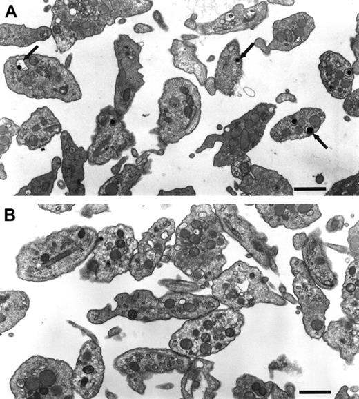 Fig. 3. A deficiency of platelet-dense granules is the only obvious ultrastructural abnormality in C3H/HeSnJ ashen mice. / Normal C3H/HeSnJ platelets (above) and mutant C3H/HeSnJ ash/ashplatelets (below) were examined by electron microscopy. The platelet pellets were osmicated and stained with 190 tannic acid in 0.05 M sodium cacodylate. Electron microscopy grids were then stained with lead citrate. Arrows indicate the typical “bulls eye” appearance of dense granules in normal platelets. Bar is 1 μm.