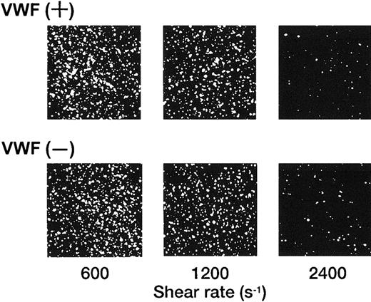 Fig. 1. Dependence of the interaction of rGPIa/IIa-liposomes with the collagen surface on shear rate. / Images were obtained after 3 minutes of perfusion on the collagen surface at different shear rates, as indicated, in the presence and absence of 10 μg/mL soluble VWF. Liposomes have an exofacial rGPIa/IIa density of 2.22 × 103 molecules per particle.