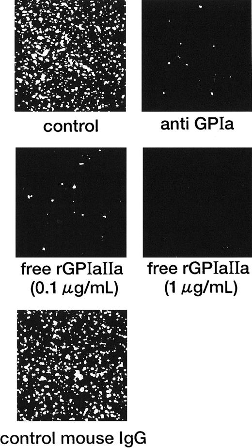 Fig. 2. Inhibitory effect of the anti-GPIa monoclonal antibody, Gi9, and free rGPIa/IIa on the interaction of rGPIa/IIa-liposomes with the collagen surface under flow conditions. / Control: images were obtained after 3 minutes of perfusion at a shear rate of 600 s−1. Liposomes have an exofacial rGPIa/IIa density of 2.22 × 103 molecules per particle. Anti-GPIa: experimental conditions were the same as control except that rGPIa/IIa-liposomes were incubated with 10 μg/mL Gi9 for 5 minutes at 37°C before perfusion. Free rGPIa/IIa: experimental conditions were the same as for the control except that 0.1 or 1.0 μg/mL free rGPIa/IIa was present in perfusion solutions. Control mouse IgG: experimental conditions were the same as control except that rGPIa/IIa-liposomes were incubated with 10 μg/mL control mouse IgG for 5 minutes at 37°C before perfusion.