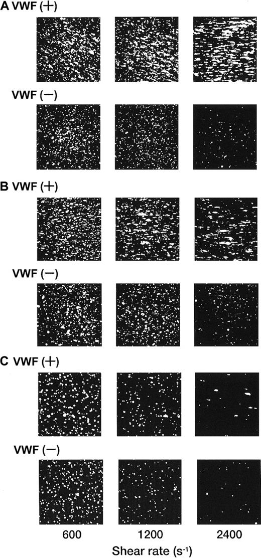 Fig. 4. Dependence of adhesion of rGPIa/IIa-Ibα-liposomes with different exofacial densities of rGPIa/IIa and rGPIbα on shear rate, in the presence and absence of VWF. / Images were obtained after 3 minutes of perfusion on the collagen surface at different shear rates, as indicated, in the presence and absence of 10 μg/mL soluble VWF. (A) The rGPIa/IIa-Ibα-liposomes with exofacial densities of rGPIa/IIa and rGPIbα at 2.17 × 103 and 1.00 × 104 molecules per particle, respectively. (B) The rGPIa/IIa-Ibα-liposomes with exofacial densities of rGPIa/IIa and rGPIbα at 2.19 × 103 and 5.27 × 103 molecules per particle, respectively. (C) The rGPIa/IIa-Ibα-liposomes with exofacial densities of rGPIa/IIa and rGPIbα at 0.96 × 103 and 1.08 × 104 molecules per particle, respectively.