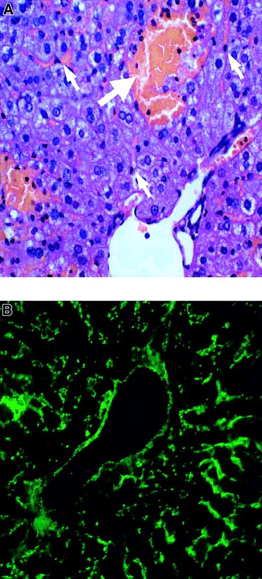 Fig. 1. Liver histology and VWF staining in AOM-induced FHF. / (A) Paraffin section AOM-50 mouse liver stained with hematoxylin and eosin and visualized by light microscopy. White arrows denote liver sinusoidal endothelial cells. Severe necrosis is identified by the bolded arrow. (B) Frozen section of AOM-50 mouse liver revealing staining of VWF in large vessel and sinusoidal endothelium by FITC immunofluorescence. Original magnification × 200 in panels A and B.