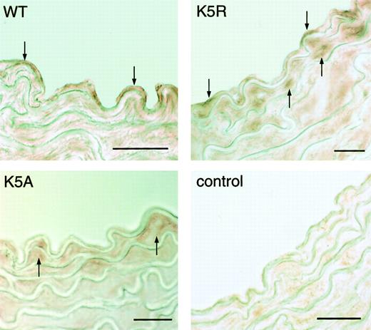 Fig. 5. Photomicrographs of cross-sections of murine aortas. / Samples were obtained 2 minutes after the injection of human factor IX (K5A, K5R, and wild type), and detected with anti-human factor IX IgG. K5A, K5R, and WT: identify the injected protein. Color was developed by AEC. Control: artery was isolated from a factor IX knockout mouse that had not received any factor IX. Down arrows indicate factor IX K5R and wild-type binding at the endothelial surface. Up arrows indicate factor IX in the region beneath the endothelium. Bar = 20 μm.