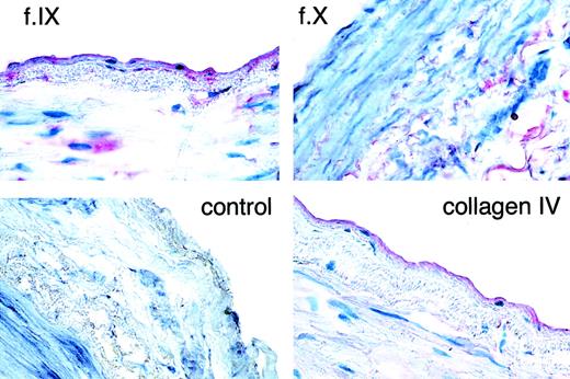 Fig. 6. Immunohistochemical detection of factor IX and collagen IV in human popliteal artery. / Frozen sections of fresh tissue were stained with polyclonal antisera to factor IX (f.IX), factor X (f.X), collagen IV, or preimmune rabbit serum (control). In each panel, the endothelial (lumenal) surface of the vessel faces the label. Note the primary localization of red staining to the endothelial surface for the factor IX and collagen IV panels. Some faint staining is also present in the subendothelium and media. By contrast, only faint staining in the media is seen for factor X. Original magnification, 400×.