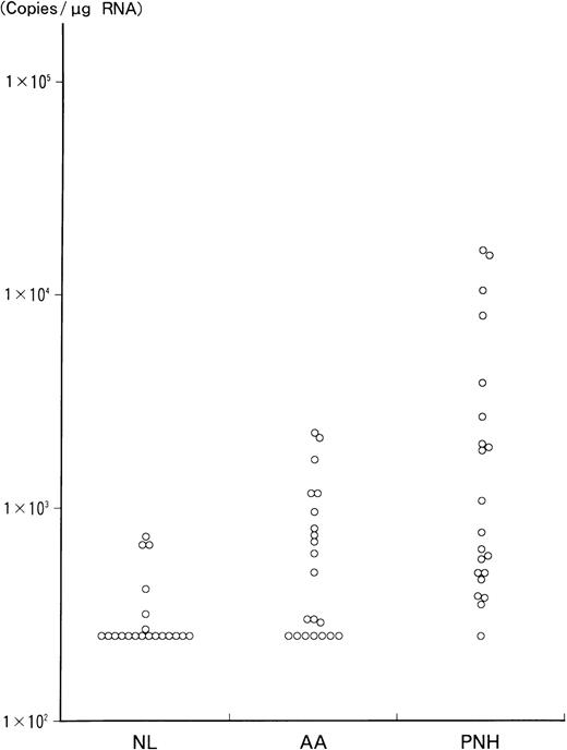 Fig. 1. Quantitation of WT1 RNA by RT-PCR in 21 PNH and AA patients and 20 normal individuals. / WT1 RNA was quantitated by RT-PCR, as described in “Materials and methods.” The values are presented in a logarithmic scale. Vertical axis shows the quantitative values (copies/μg RNA) of WT1 RNA in each individual. NL indicates normal controls.