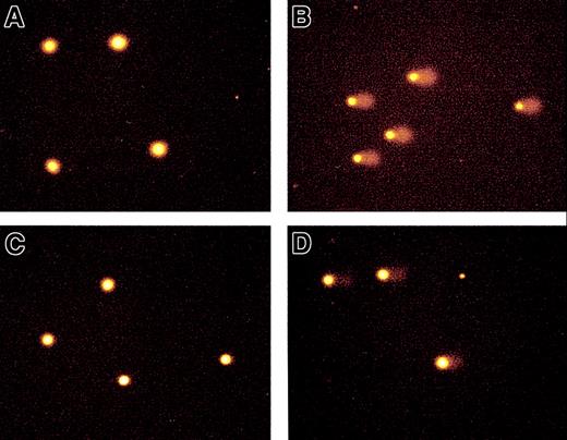 Fig. 1. Typical comet images from plasma cells treated ex vivo with melphalan. / After irradiation (10 Gy) of nondrug-treated plasma cells, distinct comets were observed (B) when compared with nondrug-treated unirradiated plasma cells (A). After treatment with 50 μM melphalan for 1 hour followed by 16 hours drug-free after incubation, no DNA single strand breaks were observed (C). After irradiation of drug-treated plasma cells, comet tails were visible but with decreased length and intensity because of the presence of melphalan-induced ICL (D). All images stained with propidium iodide. Original magnification, × 20.