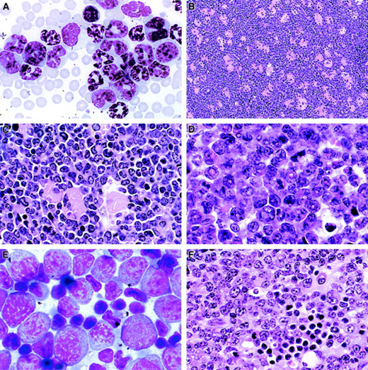 Variable appearance of myeloid leukemia in mice.