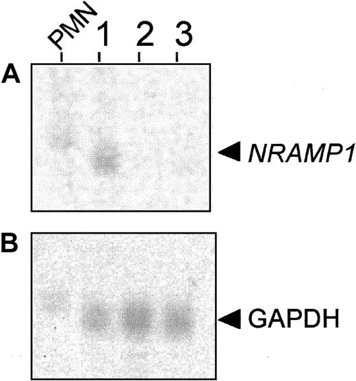 Fig. 1. NRAMP1 expression in mature granulocytes from peripheral blood (PMN leukocytes) and 3 populations of neutrophil precursors from BM. / Total RNA was extracted from (1) band 1 cells, band cells/segmented cells; (2) band 2 cells, myelocytes/metamyelocytes; and (3) band 3 cells, myeloblasts/promyelocytes and from PMN leukocytes. After separation by electrophoresis in denaturing formaldehyde gels (10 μg/lane), RNA was blotted to a hybridization membrane. The blot was probed with cDNA probes corresponding to NRAMP1 gene (A) andGAPDH gene (B) as a positive control.