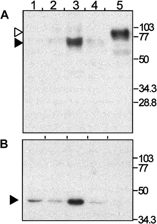 Fig. 4. Detection of NRAMP1 in human neutrophils granules by Western blotting. / An immunoblot of purified fractions (lane 1, α; lane 2, β1; lane 3, β2; and lane 4, γ; 25 μg of each fraction per lane) was probed with an antibody against NRAMP1 (NT) (A). After stripping, the membrane was reprobed with an antibody against the 39-kd subunit of the VATPase (B). As a positive control for the anti-NRAMP1 antibody, 5μg membrane proteins from U937 transfectants expressing the c-Myc–tagged NRAMP1 was included (lane 5). The positions and sizes (in kilodaltons) of the molecular weight markers are shown.