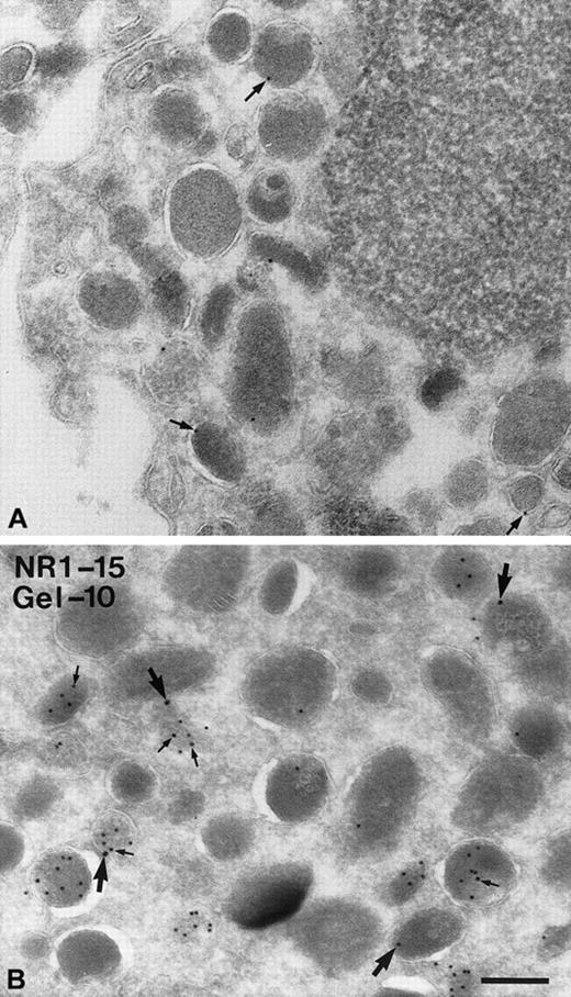 Fig. 6. Detection of NRAMP1 and gelatinase in human neutrophils granules by immunoelectron microscopy. / PMN leukocytes were fixed, cryosectioned, and labeled with anti-NRAMP1 and protein A–gold (10 nm; A) or double-labeled with antigelatinase and protein A–gold (10 nm) followed by labeling with anti-NRAMP1 and protein A–gold (15 nm; B). (A) Labeling on the membranes of some granules (arrows) is shown. (B) A population of granules is highly labeled for gelatinase on the matrix (small arrows), and labeling for NRAMP1 (large arrows) is shown on the membrane of some granules containing gelatinase and some negative for gelatinase. Bar = 200 nm.