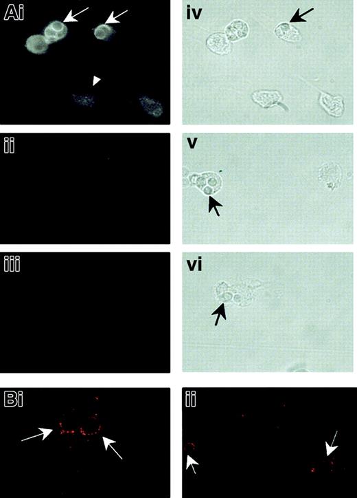 Fig. 7. NRAMP1 association withC albicans–containing phagosomes in HL-60 cells differentiated into granulocytes. / After treatment for 5 days with DMSO, HL-60 cells were allowed to ingest heat-killed C albicans for 30 minutes at 37°C. The cells were then washed free of uningested particles, fixed, and permeabilized before indirect immunofluorescence examined by using a Nikon optical fluorescence microscope (A) or a confocal microscope (B). Detection was performed with an affinity-purified rabbit anti-NRAMP1 antibody (Ai, Bi, and Bii), nonimmune serum (Aii), or no primary antibody (Aiii) on the cells. Immunofluorescence micrographs (Ai-Aiii) and the corresponding bright field images (Aiv-Avi) are shown. Arrowhead shows an intact, particle-free, differentiated HL-60 cell. Arrows point to ingested C albicans.