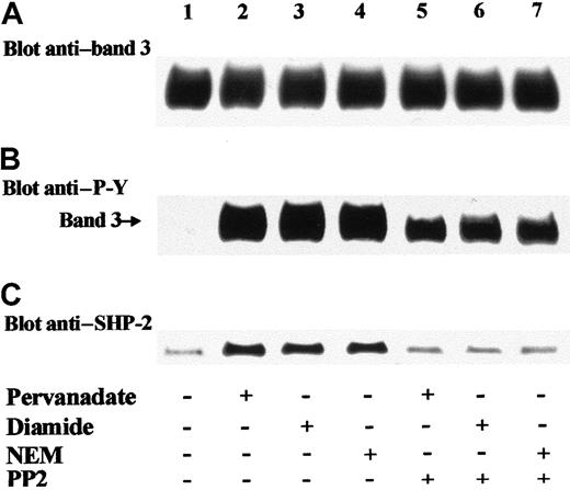 Fig. 2. SHP-2 translocation to erythrocyte membrane is mediated by PP2-sensitive phosphorylation of band 3. / Red blood cells were incubated in the absence (lane 1) or presence of 1 mmol/L pervanadate (lanes 2, 5), 2 mmol/L diamide (lanes 3, 6), or 1 mmol/L NEM (lanes 4, 7). PP2 (5 μM) was added to the incubation mixture of assays of lanes 5-7. Erythrocytes were then subjected to hemolysis, and isolated membranes were treated as described in the legend of Figure 1 (B-C). Panels are representative of 4 separate experiments.