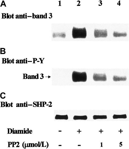 Fig. 3. Detection of Tyr-phosphorylated band 3 in anti–SHP-2 IPs. / Red blood cells were treated in the absence (lane 1) or presence of 2 mmol/L diamide (lanes 2-4). Indicated concentrations of PP2 were added to the incubation mixture of assays of lanes 3 and 4. Erythrocyte lysates were immunoprecipitated with anti–SHP-2 antibody; immunocomplexes were subjected to SDS-PAGE and immunostained with anti–band 3 antibody (A). Blots were then stripped and reprobed with anti–P-Y antibody (B). In parallel experiments, blots were first immunostained with anti–band 3 antibody and then stripped and reprobed with anti–SHP-2 antibody (C). Panels are representative of at least 4 separate experiments.
