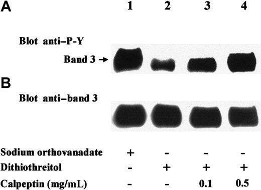 Fig. 5. SHP-2 dephosphorylates coimmunoprecipitated band 3. / Erythrocytes were treated with diamide, and extracts from cell membranes were immunoprecipitated with anti–SHP-2 antibody. Immunocomplexes were washed twice in the absence of sodium orthovanadate and then incubated for 30 minutes at 30°C in phosphatase assay buffer containing 1 mM sodium orthovanadate (lane 1) or 4 mM dithiothreitol (lanes 2-4). The indicated amount of calpeptin was present in the phosphatase assay buffer of experiments of lanes 3 and 4. After incubation, samples were submitted to SDS-PAGE, transferred to nitrocellulose, and immunostained with anti–P-Y (A) or anti–band 3 (B) antibodies. Figure represents at least 3 separate experiments.