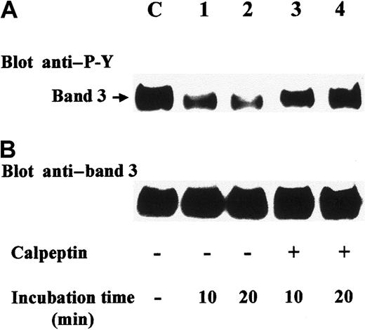 Fig. 6. Dephosphorylation of band 3 is inhibited by calpeptin in treated erythrocytes. / Erythrocytes were stimulated with 2 mM diamide in basal buffer containing calpeptin (2 mg/mL) for 20 minutes. In experiments of lanes 1-4, red cells were washed 3 times, resuspended, and incubated in basal buffer either in the absence (lanes 1, 2) or presence of calpeptin (lanes 3, 4) for 10 (lanes 1, 3) or 20 minutes (lanes 2, 4). Lane C refers to control erythrocytes treated with diamide and calpeptin without the following washes and incubation. Cell membranes were then isolated and solubilized, and an aliquot (15 μg) was submitted to SDS-PAGE, followed by transfer to nitrocellulose. Blots were immunostained with anti–P-Y antibody (A), stripped, and reprobed with anti–band 3 antibody (B). Panels are representative of 3 separate experiments.