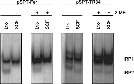 Fig. 4. RNA-binding properties of IRP1 in chicken versus murine cells. / Apparent (−2-ME) and total (+2-ME) IRP activities in chicken SCF progenitors and murine L cells (Ltk−) were compared by IRE/IRP EMSAs using IRE probes derived from pSPT-Fer and pSPT-TR34 (see “Materials and methods”). The PhosphoImages show the respective migration properties of IRP1 and IRP2. In multiple measurements, the accuracy of this assay was at least ± 12% provided a linear quantification method of the 32P signals, that is, PhosphoImage analysis, was used.
