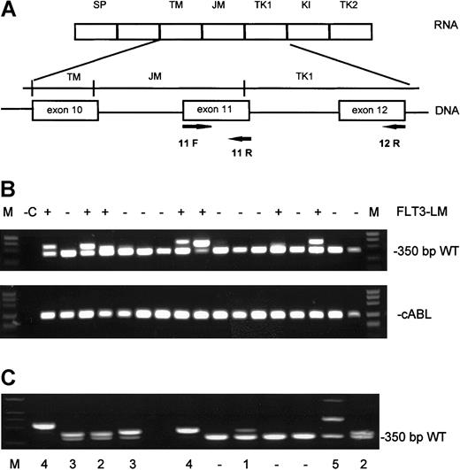 Fig. 1. Analysis of the amplification fragments on agarose gels. / (A) Genomic and mRNA structure of the FLT3 gene with position of the primers F11, R12, R5, and R6. (B; top) Ethidium bromide–stained agarose gel with RT-PCR products. (Bottom) cABL control PCR. (C) Classification of FLT3-LM according to intensities of the amplified fragments. Category 1, low intensity; category 2, as intense as wild type; category 3, more intense than wild type; category 4, only mutation; category 5, more than one mutated fragment.