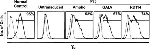 Fig. 3. Expression of γc protein on B-cell lines. / Cells from a healthy control, left. Untransduced and transduced cells from patient 2, right. Black line, cells stained with TUGh4 (anti-CD132 γc antibody); dotted line, isotype controls. Percentage of γc+ cells determined by inflection points of histograms.