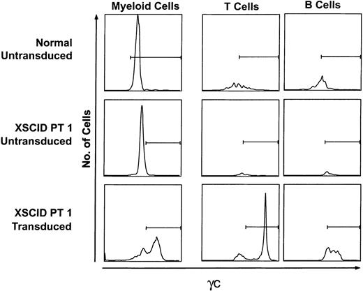 Fig. 5. Flow cytometric analysis of human cells from chimeric sheep. / Top panels, cells from a sheep receiving control peripheral human CD34+ cells; center panels, a sheep receiving untransduced XSCID CD34+ cells; bottom panels, a sheep receiving XSCID CD34+ cells transduced with RD114 MFGS-gc. Horizontal bars, positive γc gates based on less than 5% background γc expression of sheep cells (CD45−CD3−CD19− or CD45−CD11b−CD15−). For myeloid staining, untransplanted sheep were used as the negative control for setting gates.