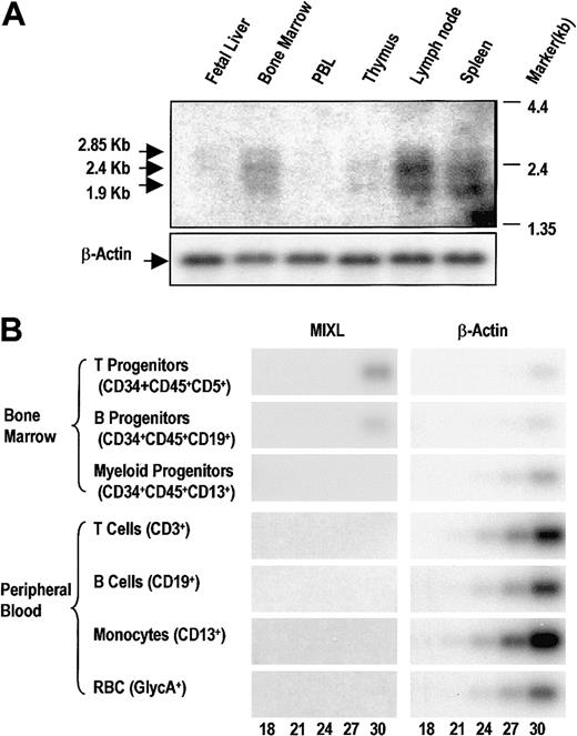 Fig. 4. MIXL expression is restricted in normal hematopoietic tissues. / (A) Human immune system multitissue Northern blot (Clontech Laboratories) was hybridized overnight with radiolabeledMIXL cDNA probe as described in “Materials and methods,” and the blot was exposed to x-ray film for 5 days. Arrows denote the 3 bands detected. The autoradiograph of the same blot rehybridized with β-actin is shown in the lower panel. PBL indicates peripheral blood leukocytes. (B) The T, B, or myeloid progenitors (1 × 103, 2.5 × 103, and 9 × 103 cells, respectively) from bone marrow or mature T cells, B cells, monocytes, and red blood cells (2 × 105, 1 × 105, 5 × 104, and 1 × 104 cells, respectively) were obtained for total RNA extraction. The RNA from each fraction was reverse-transcribed with an oligo dT primer. The cDNAs were approximately normalized based on a pilot β-actin amplification reaction. Aliquots of 2 μL of the direct or diluted cDNA pool were used in PCR of 18, 21, 24, 27, or 30 cycles with MIXL-EXP primers or β-actin primers as detailed in “Materials and methods.” The amplification products (341 bp for MIXL and 246 bp for β-actin) were resolved on a 1.5% agarose gel, transferred to Hybond N+ membrane, and probed with radiolabeled MIXL or β-actin cDNAs. The blots were exposed to the Phosphor Screen for 1 hour. The images were converted from the Phosphor Screen. The number of PCR cycles is denoted at the bottom.