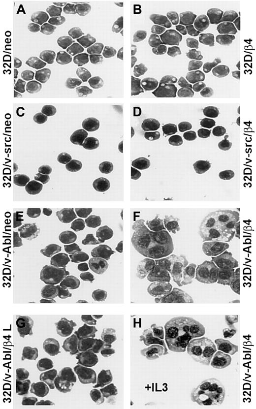 Fig. 4. Representative samples of morphologic analyses of 32D, 32D/v-src, 32D/v-Abl control neo, and derivatives of β4-transduced cells. / (A) 32D/neo cells; (B) 32D/β4 cells; (C) 32D/v-src/neo cells; (D) 32D/src/β4 cells; (E) 32D/v-Abl/neo cells; (F) 32D/v-Abl/β4 cells; (G) 32D/v-Abl/β4 L cells; (H) 32D/vAbl cells maintained in IL-3 and transduced with wild-type β4 molecule. The morphology of the cytospin-fixed cells was analyzed by May-Grunwald-Giemsa stain. Original magnification × 630.
