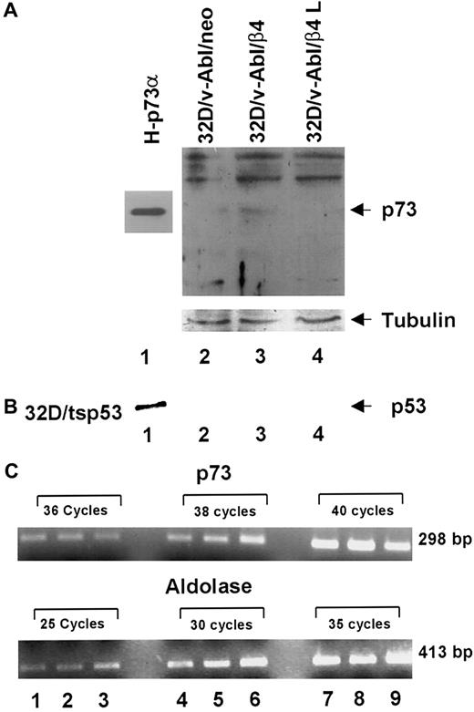 Fig. 6. Analyses of p73 protein and mRNA in 32D/v-Abl/neo cells and 32D/v-Abl cells expressing either wild-type or truncated β4 molecules. / (A) Total cell lysates from 32D/v-Abl/neo (lane 2), 32D/v-Abl/β4 wild type (lane 3), and 32D/v-Abl/β4 L (lane 4) were analyzed by SDS-PAGE and probed with anti–p73 antibody. H-p73α, stably transduced with p73α cDNA, was used as a positive control (lane 1). (B) Total cell lysates from 32D/v-Abl/neo (lane 2), 32D/v-Abl/β4 wild type (lane 3), and 32D/v-Abl/β4 L (lane 4) were analyzed by SDS-PAGE and probed with anti–mouse p53 antibody. 32D transduced with the expression vector encoding for a p53 Val 135 was used as a positive control (lane 1). The nitrocellulose used to probe p73 and p53 proteins was stripped and probed again with the anti–tubulin antibody to normalize equal loading of proteins (lanes 2, 3, and 4). (C) Total mRNA was extracted from 32D/v-Abl/neo (lanes 1, 4, and 7), from 32D/v-Abl/β4 wild type (lanes 2, 5, and 8), and from 32D/v-Abl/β4 L (lanes 3, 6, and 9). RT-PCR analysis was performed using primers specific for mouse p73 and the housekeeping aldolase gene to amplify 2 fragments of 298 bp and 413 bp, respectively. The conditions are described in “Materials and methods.” Molecular sizes of the 2 fragments are indicated.