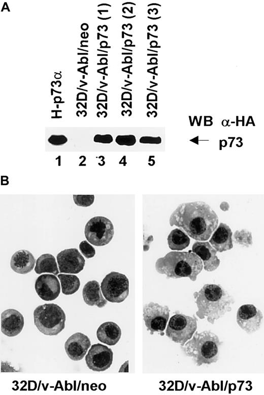 Fig. 7. Expression and morphologic analysis of 32D/v-Abl/neo and 32D/v-Abl/p73 cells. / (A) 32D/v-Abl cells were transduced with an expression vector alone and/or encoding p73 cDNA. After selection, total cell lysates from 32D/v-Abl/neo (lane 2), 3 derived 32D/v-Abl/p73α populations (lanes 3, 4, and 5), and H-p73α stably transduced with p73α cDNA (lane 1) used as a positive control were analyzed by SDS-PAGE and probed with anti–HA monoclonal antibody. (B) The morphology of the cytospin-fixed 32D/v-Abl/neo (left panel) and 32D/v-Abl/p73 (right panel) cells was analyzed by May-Grunwald-Giemsa stain as described in “Materials and methods.” Original magnification × 630.