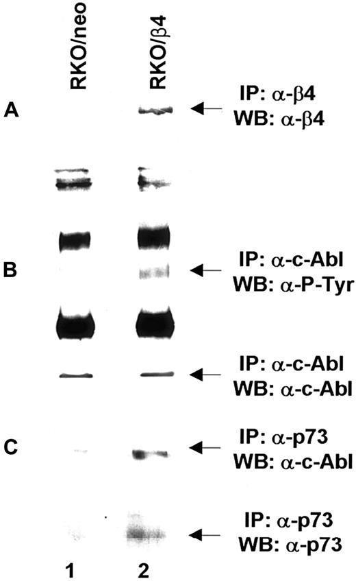 Fig. 9. Analyses of c-Abl activation on RKO/neo and β4-transfected cells. / (A) Total cell lysates (500 μg) from RKO/neo (lane 1) and RKO/β4 (lane 2) cells were immunoprecipitated with anti–β4 monoclonal antibody. The immunoprecipitated β4 proteins were analyzed by SDS-PAGE and probed with an antibody direct to the β4 integrin subunit. (B) Equal amounts of cell lysates from RKO/neo cells (lane 1) and RKO/β4 cells (lanes 2) were immunoprecipitated with anti–Abl monoclonal antibody. The immunoprecipitated Abl proteins were analyzed by SDS-PAGE and probed with antiphosphotyrosine monoclonal antibody (upper panel B). The nitrocellulose was stripped and probed again with the anti–Abl polyclonal antibody (lower panel B). (C) Equal amounts of cell lysates from RKO/neo cells (lane 1) and RKO/β4 cells (lanes 2) were immunoprecipitated with anti–p73 polyclonal antibody and probed with anti–cAbl antibody (upper panel C). The nitrocellulose was stripped and probed again with the anti–p73 antibody (lower panel C).