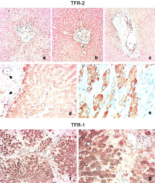 Fig. 4. Immunohistochemistry analysis of TFR-2 and TFR-1 molecules in human liver. / Three of 9 mAbs (A, G/5F8; B, G/14C2; C, G/1C11) clearly react with TFR-2 in normal formalin-fixed and paraffin-embedded liver tissue sections (original magnification, panels A-C, × 10). The reactivity is confined to hepatocytes and is strongly cytoplasmic (original magnification, panel E, × 100), whereas endothelial or bile duct cells are not stained (D, arrows; original magnification, × 40). (D,E) Images taken by using the G/5F8 mAb. TFR-1 protein displays an almost overlapping expression and localization (original magnifications, panel F, × 10; panel G, × 40). Representative data from 3 separate specimens are shown.