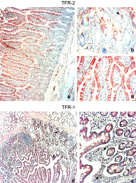 Fig. 5. Immunohistochemistry analysis of TFR-2 and TFR-1 molecules in small intestine. / Immunoperoxidase staining of the TFR-2 protein shows that the signal is widely distributed along the crypt/villus axis (A; original magnification, × 10), with some cells intensely stained in the crypts (B; original magnification, × 40), whereas the villus is homogeneously stained (C; original magnification, × 40). The reactivity is mostly cytoplasmic, without nuclear staining (B,C). Some lamina propria leukocytes are stained (B,E, arrows). TFR-1 protein is detectable in the crypts and villi, with diffuse intracellular and basolateral membrane-associated localizations (D, original magnification, × 10; and E, original magnification, × 40). Representative pictures from 3 different specimens are shown. TFR-2 protein was stained using G/14C2 mAb.