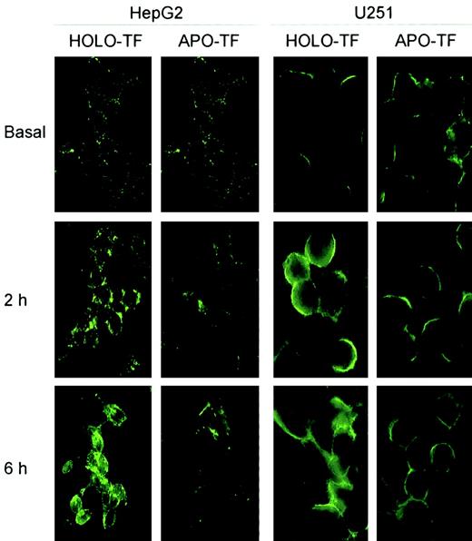 Fig. 7. TF influence on TFR-2 expression in adherent cells. / HepG2 (hepatocarcinoma) and U251 (glioblastoma) were grown on coverslips, exposed to TF for 2 and 6 hours, respectively, and evaluated for TFR-2 expression. Results show the presence of discrete membrane areas in which TFR-2 is localized, more apparent in basal and in 2-hour conditions. In vitro incubation is paralleled by a constant increase in TFR-2 expression, which appears uniformly deployed on the surface after 6-hour incubation. The observed effects are dependent on the presence of HOLO-TF. APO-TF was ineffective in inducing detectable or comparable effects. TFR-2 protein was stained using G/14C2 mAb. Representative images from 5 independent experiments are shown.