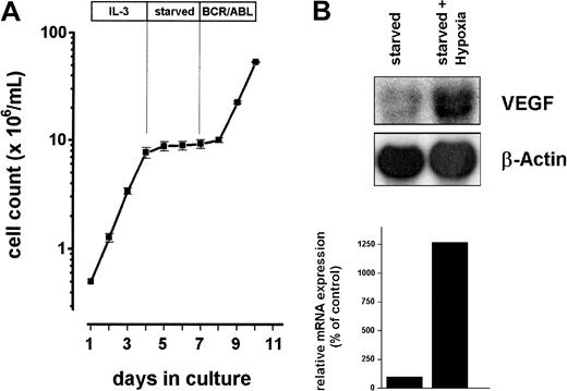 Fig. 1. Growth kinetics and induction of VEGF in Ton.B210-X cells. / (A) Ton.B210-X cells were grown in IL-3 for 3 days, starved of IL-3 for another 3 days, and then induced to express BCR/ABL by the addition of doxycycline. (B) Ton.B210-X cells were starved for 48 hours and were maintained under hypoxic conditions (starved + hypoxia) or normal atmosphere (starved) overnight. Total RNA was extracted and subjected to Northern blot analysis using a murine VEGF probe. The β-actin loading control and densitometric evaluation of VEGF mRNA expression relative to β-actin mRNA expression (relative mRNA expression) is shown below the blot analyses.
