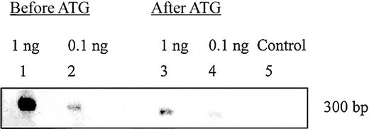 Fig. 6. Detection of CDR3 sequences before and after ATG-based treatment. / The TCR-Vβ 18 family of UPN 8 contained a clonal T-cell expansion that persisted 6 months after ATG treatment. The detection of the target DNA sequence was performed on TCR-Vβ 18 PCR product using an oligonucleotide probe with the shared CDR3 sequence of the clonal T-cell expansion. Lane 1 was loaded with 1 ng and lane 2 with 0.1 ng target DNA product from pretreatment PBMCs of UPN 8. Lane 3 was loaded with 1 ng and lane 4 with 0.1 ng target DNA product from posttreatment PBMCs of UPN 8. Lane 5 is a negative control in which 2 ng of the reverse-transcribed PCR product of the TCR-Vβ 18 family from a healthy donor was probed.