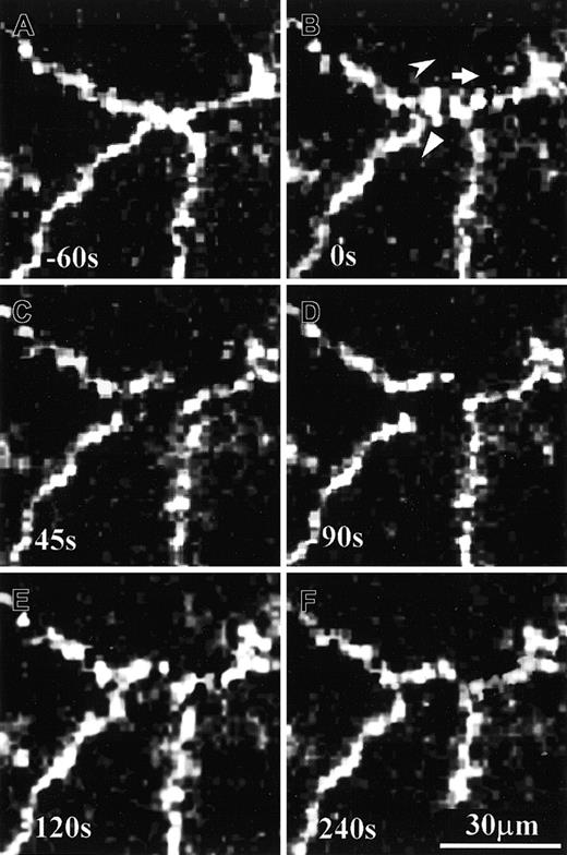 Fig. 3. Time sequence of VE-cadherin movements on cultured HUVECs during PMN transmigration. / At time 0 seconds (B) a PMN started transmigrating through a monolayer of living HUVEC specimen that was previously immunostained with anti–VE-cadherin antibody and Alexa Fluor–conjugated secondary antibody. VE-cadherin clusters moved intermittently to create a stain-free area that corresponded to the location of PMN transmigration. Three different symbols point at the momentary moving directions of 3 VE-cadherin clusters (B). This PMN transmigration process was completed in about 120 seconds, and the resealed tricellular corner was about 10 μm left to its original location (compare panels A and F).