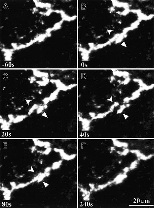 Fig. 4. Time sequence of PECAM-1 movement on cultured HUVECs during PMN transmigration. / A PMN was transmigrating through a monolayer of living HUVEC specimen that was previously immunostained with anti–PECAM-1 antibody and Alexa Fluor–conjugated secondary antibody. Symbols indicate the momentary moving directions of 2 adjacent PECAM-1 clusters (B-E). This PMN transmigration process was completed in about 80 seconds, and the resealed bicellular boundary was restored almost to its original state (compare panels A and F).