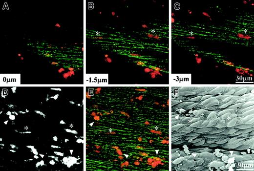 Fig. 5. Transendothelial migration of PMNs on human umbilical vein tissue. / (A-E) Living confocal images with PMNs stained with FM 1-43 (red) and endothelial VE-cadherin immunostained with Alexa Fluor 488 (green), whereas panel F shows a scanning electron micrograph of the same specimen after fixation. (A-C) Individual optical sections obtained from different depths; (D) a depth-combined image of FM 1-43; (E) a depth-combined image of both FM 1-43 and Alexa Fluor 488. Among numerous PMNs shown here, 2 transmigrated PMNs are indicated by asterisks, and 3 adhered PMNs are indicated by triangles.