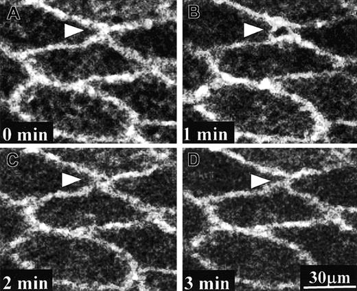Fig. 7. Time sequence of PECAM-1 movement on human umbilical vein tissue during PMN transmigration. / A PMN (stained with FM 1-43, located within the framed area) was transmigrating through the endothelium of human umbilical vein tissue that was previously immunostained with PECAM-1 antibody (Alexa Fluor 488). For picture clarity, only Alexa Fluor 488 images are displayed here. Different panels showed the depth-combined confocal images of PECAM-1 obtained at different times as indicated. PECAM-1 molecules around the transmigration site moved away from one another to leave an opening at 1 minute and almost resealed at 2 minutes. By the end of this PMN transmigration process the interendothelial boundary restored almost to the original state.