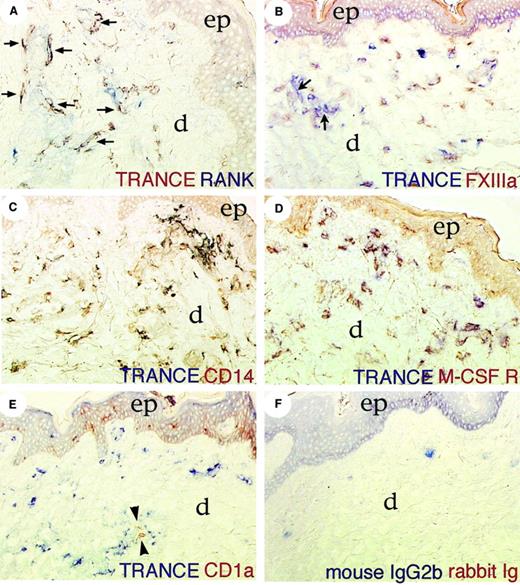 Fig. 1. Identification of dermal TRANCE+RANK+ cells. / Immunolabeling of healthy human skin for TRANCE, RANK, and other antigens as indicated (B-E). (A) Arrows highlight double-positive cells. (B) Arrows point to dermal blood vessels. (E) Arrowheads highlight CD1a+ cells in the dermis. (F) Incubation with TRANCE isotype control and rabbit preimmune serum. In all panels, ep indicates epidermis; d, dermis. Original magnification: A, C, D × 160; B, E, F × 125. Development was done using Fast Blue and 3,3′ diaminobenzidine (DAB).
