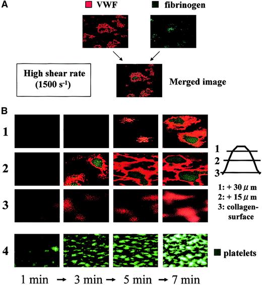 Fig. 4. Temporal changes in distribution of VWF and fibrinogen in thrombi generated under high shear rate conditions. / Whole blood without mepacrine labeling from healthy controls was perfused over a collagen surface under a high shear rate (1500 s−1). Thrombi generated at several time points (1, 3, 5, and 7 minutes of perfusion) were fixed, double-stained with Cy3-labeled anti-VWF and Cy2-labeled antifibrinogen antibody, and viewed by CLSM. (A) Merged CLSM images were obtained by the superimposition of 2 images of the identical portion and slice of thrombi; orange or green colors indicate VWF and fibrinogen, respectively, within thrombi. (B) CLSM images displayed in rows 1, 2, and 3 (left) are cross-sections at a height of 30, 15, and 0 μm from the collagen surface, respectively (right; original magnifications, × 400). Images are representative of 3 independent perfusions using blood from 3 individual donors. Images in row 4 taken at time points corresponding to those of the upper rows in a real-time observation with epifluorescence microscopy are displayed as a reference, in which platelet thrombi are visualized by mepacrine green fluorescence (original magnification, × 200). Note the gradual accumulation of fibrinogen at the inner areas of thrombi, as they grow, whereas the outer areas, including the portions adjacent to the collagen surface, are constantly occupied by VWF.