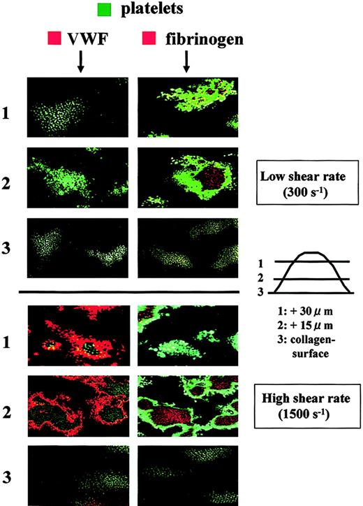 Fig. 6. Distribution of adhesive proteins and platelets in thrombi generated in perfusion of normal control blood under a low or high shear rate condition. / Whole blood from a healthy control containing mepacrine-labeled platelets was perfused over a collagen surface with a low (300 s−1) or high (1500 s−1) shear rate for 7 minutes. Fixed thrombi on coverslips were stained with a Cy3-labeled anti-VWF or antifibrinogen antibody and analyzed by CLSM. Merged CLSM images were obtained by the superimposition of 2 images at the identical portion and slice of thrombi; green indicates platelets in thrombi; orange indicates VWF (left panels) and fibrinogen (right panels). CLSM images displayed in rows 1, 2, and 3 are cross-sections at a height of 30, 15, and 0 μm from the collagen surface, respectively (original magnifications, × 400). Images are representative of 5 independent perfusions using blood from 5 individual donors. Under high shear rate conditions, VWF is predominantly distributed at the outer areas of thrombi, whereas fibrinogen is present at the inner areas. In contrast, only fibrinogen appears in thrombi under low shear rate conditions.