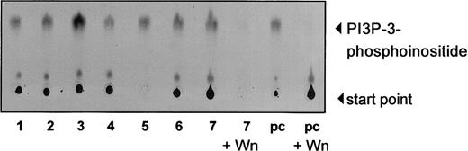 Fig. 2. PI-3K is constitutively activated in B-CLL cells. / PI-3K activity was measured by incubation of anti-p85 antisera with PI and P32-γg-ATP. P32-labeled enzymatic products of PI-3K were resolved by TLC using a silica gel, as described in “Materials and methods,” and visualized by autoradiography. Total cell lysate (200 μg) of freshly isolated B-CLL cells was used for immunoprecipitation. Lanes 1 to 7 show constitutive PI-3K activity of 7 different CLL samples. IL-3–stimulated (2 ng/mL) Ba/F3 cells were used for positive control (pc). Kinase reaction could be inhibited sufficiently by adding 300 nM wortmannin (Wn) to the reaction (lanes 8 and 10).