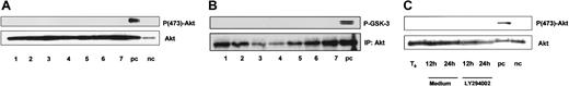 Fig. 6. PKB/Akt is expressed but not constitutively phosphorylated in B-CLL. / B-CLL cells were lysed immediately after separation from peripheral blood. (A) Whole protein lysates (100 μg) from 7 different patients were analyzed by immunoblotting with the antibodies as indicated. NIH-3T3 cells treated with platelet-derived growth factor (PDGF) served as a positive control (pc); without PDGF as a negative control (nc). (B) Akt in vitro kinase assay was performed after immunoprecipitation of Akt from 7 different patients; GSK-3 fusion protein served as exogenous substrate for Akt. Kinase reaction was analyzed by immunoblotting with mAb specific for phospho-GSK-3 (Ser21/9). (C) To rule out in vitro phosphorylation of Akt, B-CLL cells were incubated with or without 10 μM LY294002 and lysed after 12 and 24 hours.