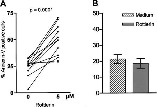 Fig. 8. Influence of PKCδ inhibition on viability of B-CLL cells. / Cells (1 × 106 cells/mL) were incubated with or without Rottlerin (5 μM), which specifically inhibits PKCδ. After 24 hours apoptosis was measured by annexin/PI staining. Panel A shows the results of 12 different experiments. The proapototic effect was compared with peripheral B cells of 5 healthy donors (B).