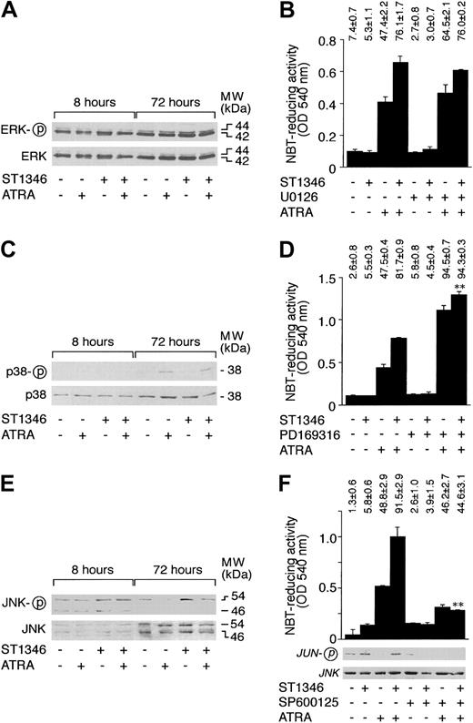 Fig. 9. Influence of ST1346 and ATRA on the phosphorylation of MAP kinases and effect of MAP kinase inhibitors on the granulocytic differentiation of NB4 cells caused by ATRA and combinations of ATRA + ST1346. / (A,C,E) NB4 cells were treated for the indicated amount of time with vehicle, ATRA (0.1 μM), ST1346 (10 μM), or the combination of the 2 compounds. Total cellular extracts were subjected to Western blot analysis using polyclonal antibodies recognizing ERK, p38, or JNK and the corresponding phosphorylated forms, as indicated by the circled ‘p’. The positions of selected molecular weight markers are indicated on the right. The blots shown are representative of 5 independent experiments. (B,D,F) NB4 cells were treated for 3 days with vehicle (DMSO), ATRA (0.1μM), ST1346 (10 μM), the ERK inhibitor U0126 (10 μM), the p38 inhibitor PD169316 (10 μM), the JNK inhibitor SP600125 (10 μM), or the indicated combinations of the various compounds. Aliquots of the extracts were used for the determination of NBT-reducing activity. In the case of panel F, we also measured the level of JNK kinase activity on JNK immunoprecipitates, using c-Jun as a substrate. Equivalent amounts of immunoprecipitates were electrophoresed on sodium dodecyl sulfate–polyacrylamide gel electrophoresis (SDS-PAGE), blotted on nitrocellulose, and challenged with antibodies recognizing the phosphorylated form of c-JUN (serine/63) or JNK. The results are shown underneath the column graph. The number of NBT+ cells is also shown above each panel. Results are expressed as the means ± SD of 3 separate culture dishes and are representative of at least 3 independent experiments. **Significantly higher or lower than the corresponding group treated with ATRA + ST1346 (P < .01 according to the Studentt test).