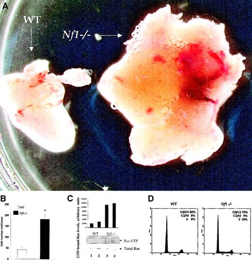 Fig. 2. Nf1 homozygosity results in thymic hyperplasia. / (A) Size comparison between WT and Nf1−/− thymi. RAG2−/− mice that received equal numbers of WT orNf1−/− fetal liver or bone marrow hematopoietic stem and progenitor cells and were killed 2 to 3 months after transplantation. Shown is a representative WT andNf1−/− thymus from a total of 16 analyzed. Original magnification, × 10. (B) Quantitative comparison of thymic cellularity in RAG2−/− mice that received WT and Nf1−/− fetal liver or bone marrow cells. Single cell suspensions from WT andNf1−/− thymi were prepared and counted. Bars represent the absolute numbers of thymocytes (± SEM) from 13 different mice. * P < .001. (C) Ras activity of freshly isolated WT (lanes 1,2) and Nf1−/− (lanes 3,4) thymocytes. GTP-bound Ras levels were determined by incubating cell lysates with Raf-1 RBD conjugated to agarose beads and by immunoblotting with an anti-Ras antibody. Immunoblots and quantitative densitometry for Ras-GTP levels and Western blot for total Ras from 2 separate WT and Nf1−/− mice are shown. (D) Cell cycle analysis of WT and Nf1−/−thymocytes shown in (A). Single cell suspensions from WT andNf1−/− thymi were stained with propidium iodide and analyzed by flow cytometry, and the percentage of cells from different phases of cell cycle is shown.
