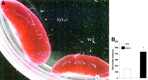 Fig. 4. Nf1 homozygosity results in splenic hyperplasia. / (A) Comparison of splenic size between WT and Nf1−/− mice. RAG2−/− mice received equal numbers of WT orNf1−/− fetal liver or bone marrow hematopoietic stem and progenitor cells and were killed 2 to 3 months after transplantation. Shown are representative WT andNf1−/− spleens from a total of 7 analyzed with similar results. Original magnification, × 10. (B) Quantitative comparison of splenic cellularity in RAG2−/− mice that received WT andNf1−/− fetal liver or bone marrow cells. Single cell suspensions from WT and Nf1−/−spleens were prepared and counted. Bars represent the absolute numbers of splenocytes (± SEM) from a total of 7 mice of each type. * P < .0005.