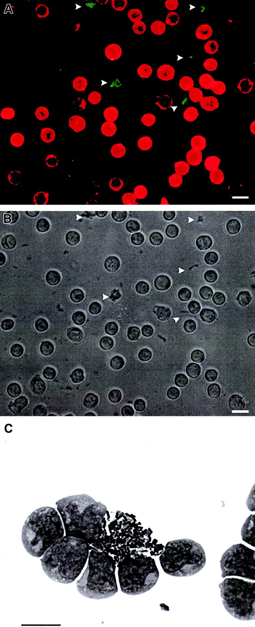 Fig. 2. Quiescent HSCs are resistant to infection by bacteria. / (A) Fluorescence microscopic image. Detection of CD34+ HSCs (stained with anti–CD34-PE antibodies) and extracellular, green fluorescent L monocytogenes(arrowheads) carrying the gfp gene under control of the constitutively active sod promotor (1 hour after infection; bar, 10 μm). (B) Light microscopic image of the identical field (1 hour after infection; bar, 10 μm); bacteria are marked with arrowheads. (C) No uptake of Y enterocolitica in quiescent HSCs (Giemsa staining at 24 hours after infection; bar, 10 μm).